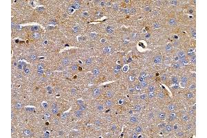 ABIN6258366 and ABIN6275720 at 1/100 staining rat brain tissue by IHC-P. (IKZF2 anticorps  (Internal Region))