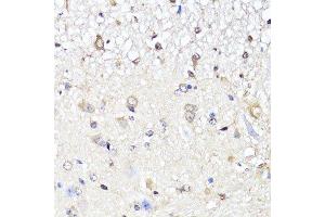 Immunohistochemistry of paraffin-embedded mouse spinal cord using YAP1 antibody.