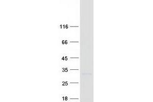 Validation with Western Blot