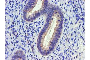 Image no. 1 for anti-Diacylglycerol Kinase, alpha 80kDa (DGKA) antibody (ABIN1497815) (DGKA anticorps)