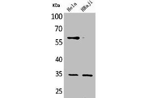 Western Blot analysis of HeLa Raji cells using CD32 Polyclonal Antibody (FCGR2B anticorps  (C-Term))