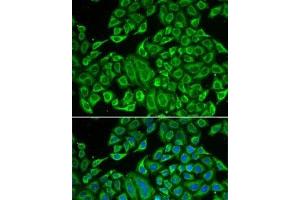 anti-Interleukin 12 Receptor beta 1 (IL12RB1) antibody