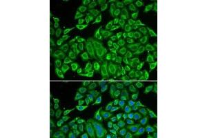 Immunofluorescence analysis of MCF7 cells using IL12RB1 Polyclonal Antibody (IL12RB1 anticorps)