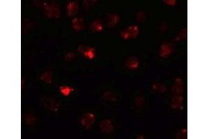 Immunofluorescencent staining of 3T3 cells with PIWIL3 polyclonal antibody  at 20 ug/mL. (PIWIL3 anticorps  (N-Term))