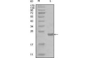 Western blot analysis using CHUK mouse mAb against truncated Trx-CHUK recombinant protein (1). (IKK alpha anticorps  (AA 500-590))