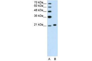 Ankyrin 1 antibody used at 1.