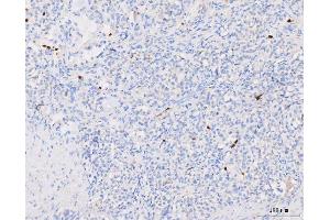 IHC analysis of Grancalcin/GCA using anti-Grancalcin/GCA antibody (ABIN6719568). (Grancalcin anticorps  (AA 42-217))