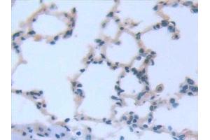 Detection of IL6 in Rat Lung Tissue using Monoclonal Antibody to Interleukin 6 (IL6)