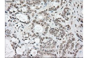 Image no. 10 for anti-Sjogren Syndrome Antigen B (SSB) antibody (ABIN1501146)