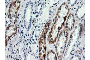 Immunohistochemical staining of paraffin-embedded Human Kidney tissue using anti-AK4 mouse monoclonal antibody. (AK4 anticorps)