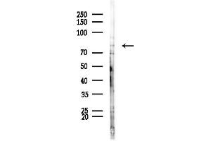 Western blot analysis of lysates from HepG2 cells(LPS,4h treatment), using ARHGEF16 Antibody at 1/1000 dilution.