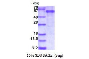 SDS-PAGE (SDS) image for Ectodysplasin A Receptor (EDAR) (AA 27-448) protein (His tag) (ABIN5853900)