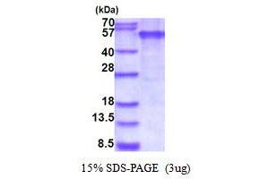 SDS-PAGE (SDS) image for Ectodysplasin A Receptor (EDAR) (AA 27-448) protein (His tag) (ABIN5853900) (EDAR Protein (AA 27-448) (His tag))