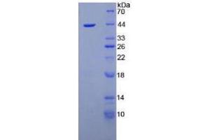 Image no. 1 for Nesfatin-1 (NES1) (AA 26-106) (Active) protein (His tag,GST tag) (ABIN6239855)