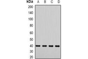 Western blot analysis of LIC3 expression in Jurkat (A), A549 (B), mouse testis (C), rat testis (D) whole cell lysates. (DYNC2LI1 anticorps)
