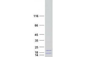 Validation with Western Blot