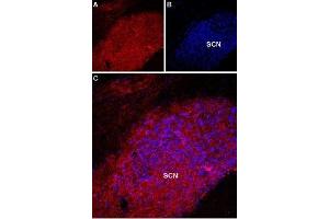 Expression of Melatonin receptor type 1A in rat supra-chiasmatic nucleus - Immunohistochemical staining of rat supra-chiasmatic nucleus (SCN) with Anti-Melatonin Receptor 1A (MTNR1A) Antibody (ABIN7043326, ABIN7044599 and ABIN7044600). (Melatonin Receptor 1A anticorps  (3rd Intracellular Loop))