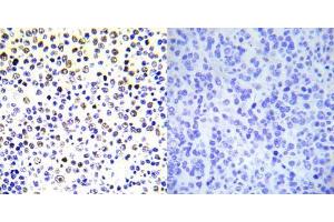 Immunohistochemical analysis of paraffin- embedded human malignant lymphoma tissue using Histone H3. (Histone H3.1 anticorps)