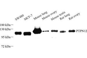 Western blot analysis of PTPN12 (ABIN7075292) at dilution of 1: 500 (PTPN12 anticorps)