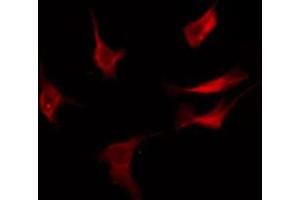 ABIN6276089 staining COLO205 by IF/ICC.