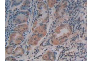 Detection of SDF1 in Human Stomach Tissue using Polyclonal Antibody to Stromal Cell Derived Factor 1 (SDF1)