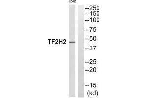 Western blot analysis of extracts from COLO205 cells, using TF2H2 antibody.