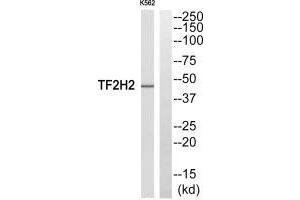 Western blot analysis of extracts from COLO205 cells, using TF2H2 antibody. (GTF2H2 anticorps  (N-Term))