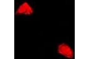 Immunofluorescent analysis of PPP2R2A staining in U2OS cells.