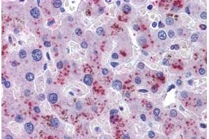 Liver, Human: Formalin-Fixed, Paraffin-Embedded (FFPE)