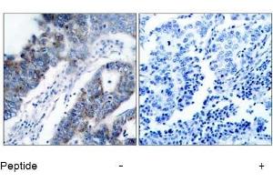 Image no. 1 for anti-Mitogen-Activated Protein Kinase Kinase Kinase 5 (MAP3K5) (Ser83) antibody (ABIN197310)
