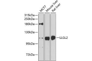 Western blot analysis of extracts of various cell lines, using LLGL2 antibody (ABIN6131794, ABIN6143262, ABIN6143265 and ABIN6224298) at 1:1000 dilution.