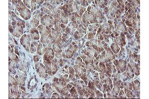 Image no. 3 for anti-Mitogen-Activated Protein Kinase Kinase 3 (MAP2K3) antibody (ABIN1499399)