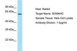 Image no. 1 for anti-Ankyrin Repeat Domain 57 (ANKRD57) (AA 128-177) antibody (ABIN6750153)