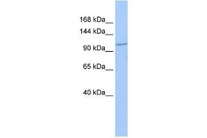 IFT122 antibody used at 1 ug/ml to detect target protein. (IFT122 anticorps)