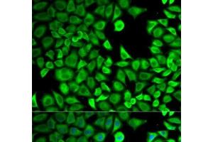 Immunofluorescence analysis of HeLa cells using LTA4H Polyclonal Antibody (LTA4H anticorps)