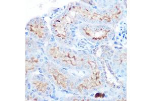 Immunohistochemistry of paraffin-embedded human esophageal using TNFSF13B Rabbit pAb (ABIN6127582, ABIN6149343, ABIN6149344 and ABIN6221563) at dilution of 1:100 (40x lens). (BAFF anticorps  (AA 76-285))
