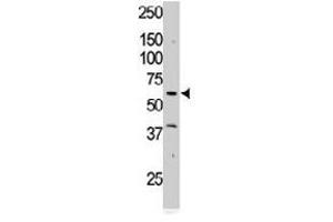The RYK polyclonal antibody  is used in Western blot to detect RYK in Jurkat cell lysate. (RYK anticorps  (AA 150-200))