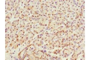 Immunohistochemistry of paraffin-embedded human pancreatic tissue using ABIN7167513 at dilution of 1:100 (PTPRO anticorps  (AA 30-300))