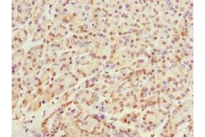 Immunohistochemistry of paraffin-embedded human pancreatic tissue using ABIN7167513 at dilution of 1:100