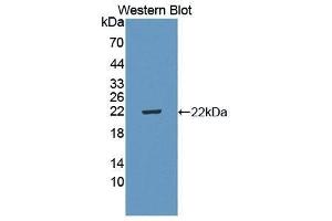 Western Blotting (WB) image for anti-Interleukin 5 Receptor, alpha (IL5RA) (AA 41-203) antibody (ABIN3206508) (IL5RA anticorps  (AA 41-203))