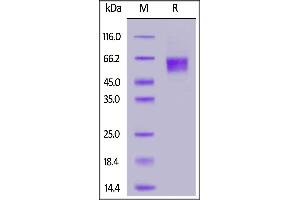 Biotinylated Human IL-3 R alpha, His,Avitag on  under reducing (R) condition.