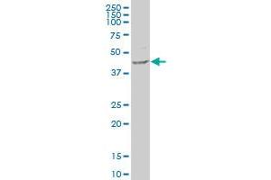 B3GNT3 polyclonal antibody (A01), Lot # 060519JCS1 Western Blot analysis of B3GNT3 expression in HeLa .