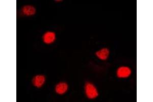 Immunofluorescent analysis of ZNF187 staining in HL60 cells.