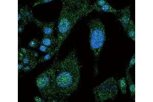 Confocal immunofluorescent analysis of NOTCH3 antibody with HepG2 cells followed by Alexa Fluor 488-conjugated goat anti-rabbit lgG (green).