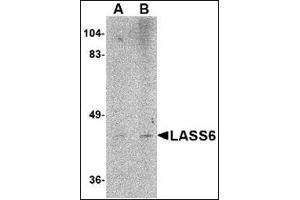 Western blot analysis of LASS6 in rat brain tissue lysate AP30493PU-N at (A) 1 and (B) 2 μg/ml.