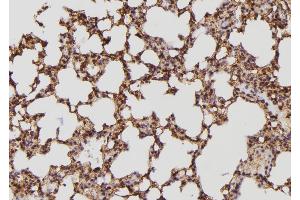 ABIN6274127 at 1/100 staining Mouse lung tissue by IHC-P. (BCAR3 anticorps  (C-Term))