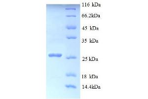 SDS-PAGE (SDS) image for Myelin Transcription Factor 1 (MYT1) (AA 900-1101), (partial) protein (His tag) (ABIN5713002)