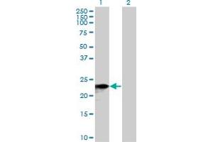 SNX10 anticorps  (AA 1-201)