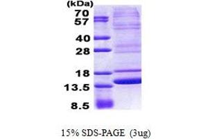 SDS-PAGE (SDS) image for Neuromedin B (AA 25-121) protein (His tag) (ABIN5853037)