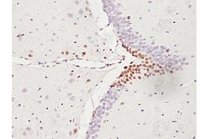 Formalin-fixed and paraffin embedded rat brain labeled with Anti-ATF6 Polyclonal Antibody, unconjugated (ABIN732293) followed by incubation with conjugated secondary antibody and DAB staining